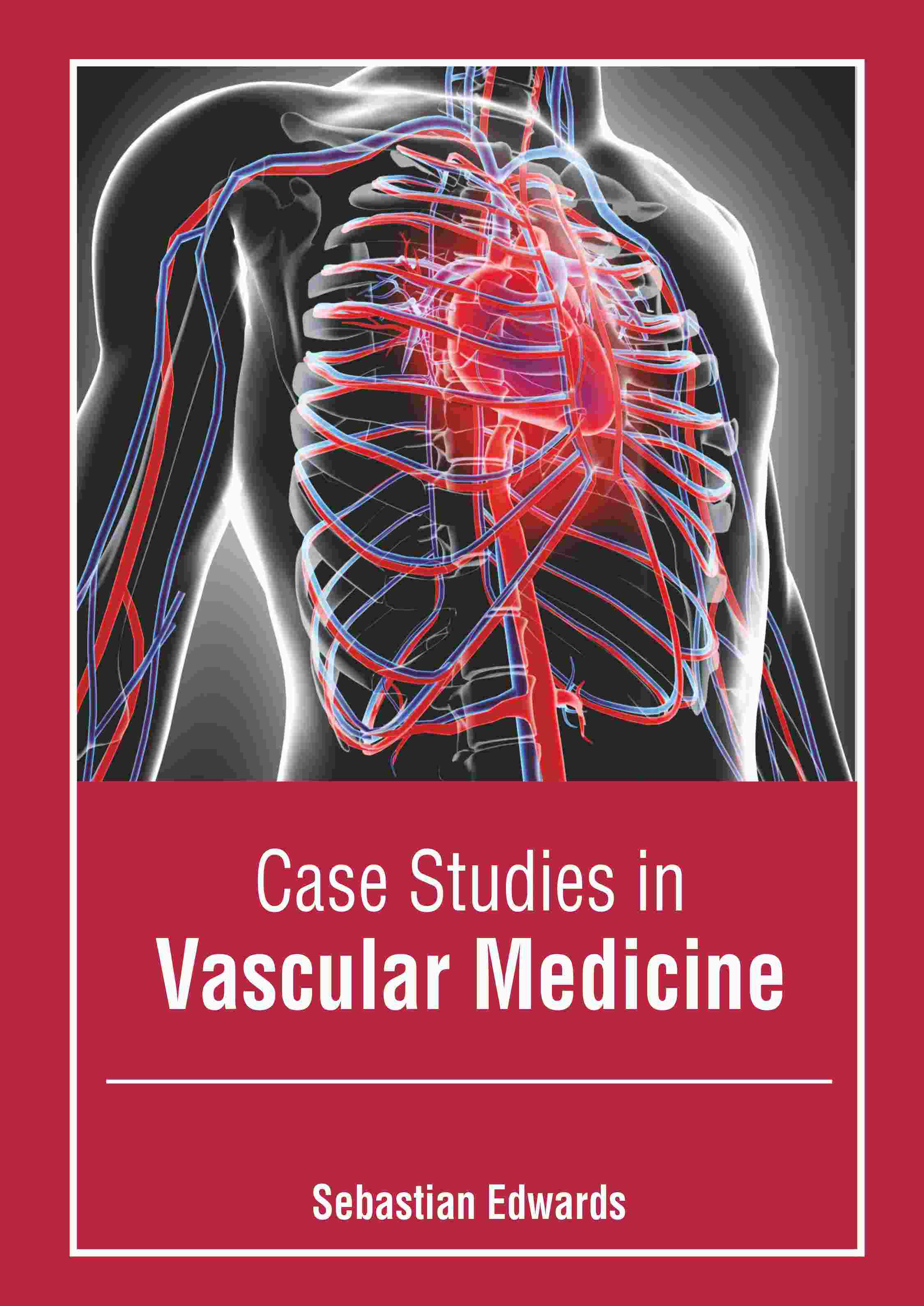 

exclusive-publishers/american-medical-publishers/case-studies-in-vascular-medicine-9798887406190