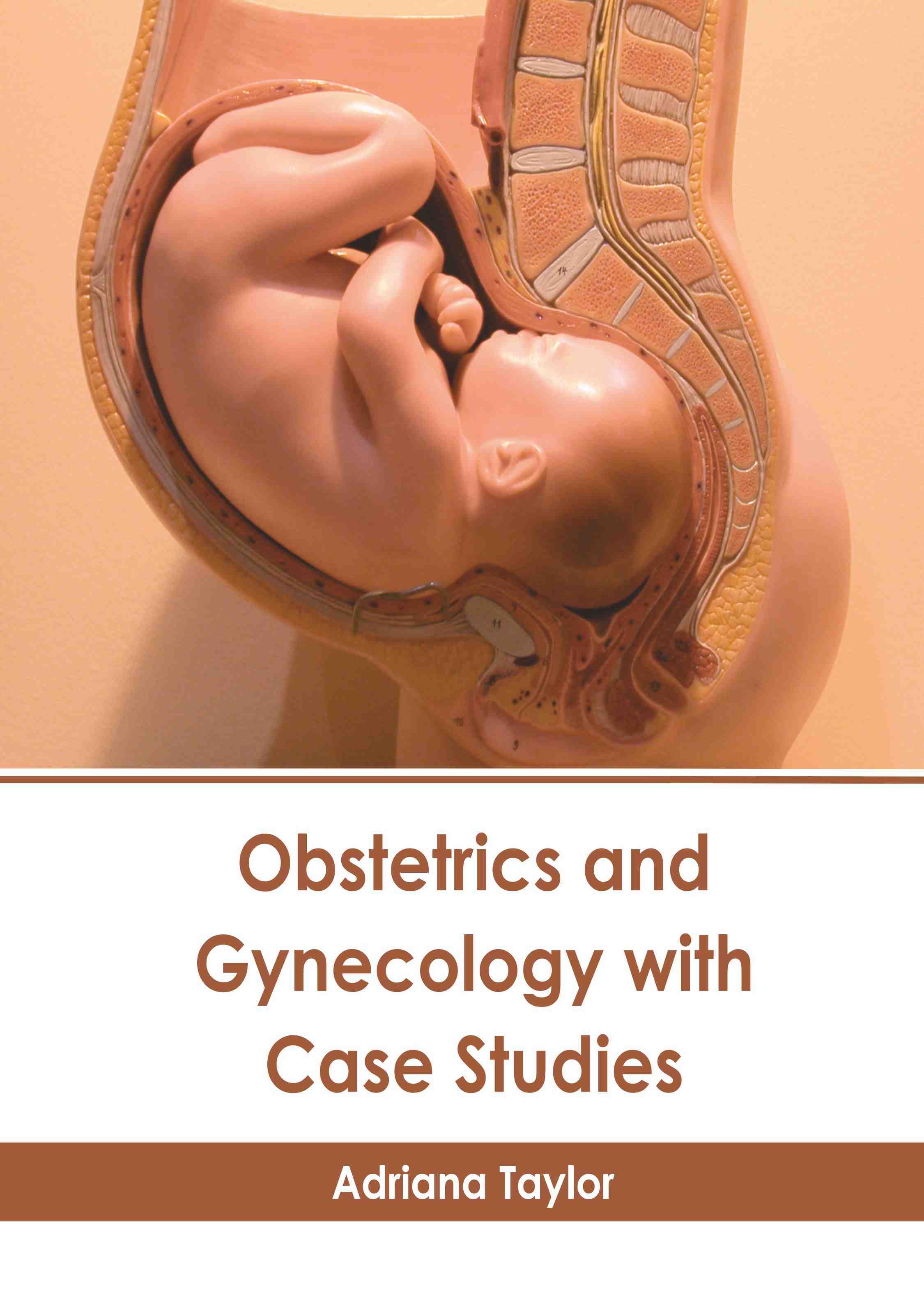 

exclusive-publishers/american-medical-publishers/obstetrics-and-gynecology-with-case-studies-9798887406480