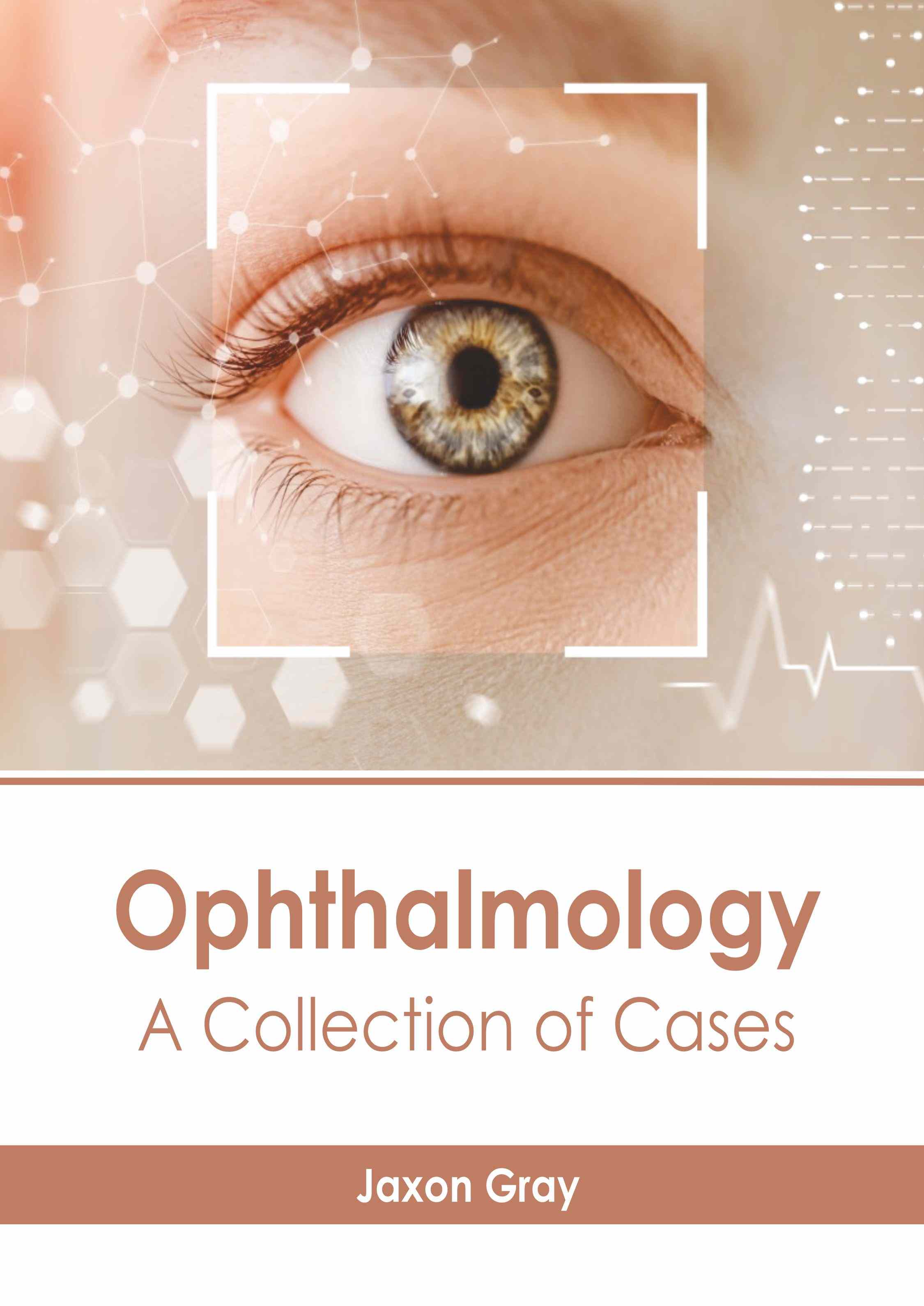 

exclusive-publishers/american-medical-publishers/ophthalmology-a-collection-of-cases-9798887406503