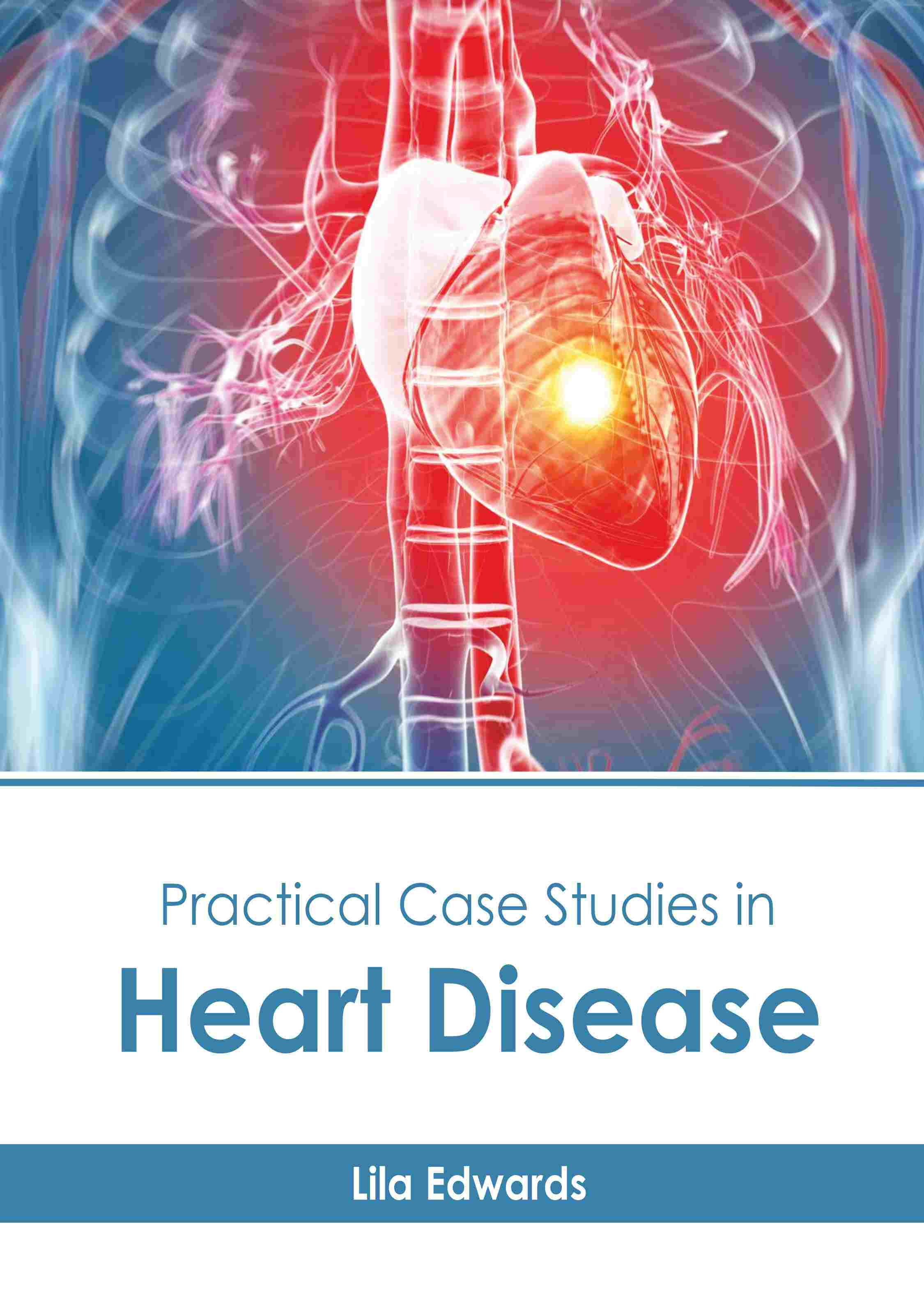 

exclusive-publishers/american-medical-publishers/practical-case-studies-in-heart-disease-9798887406558