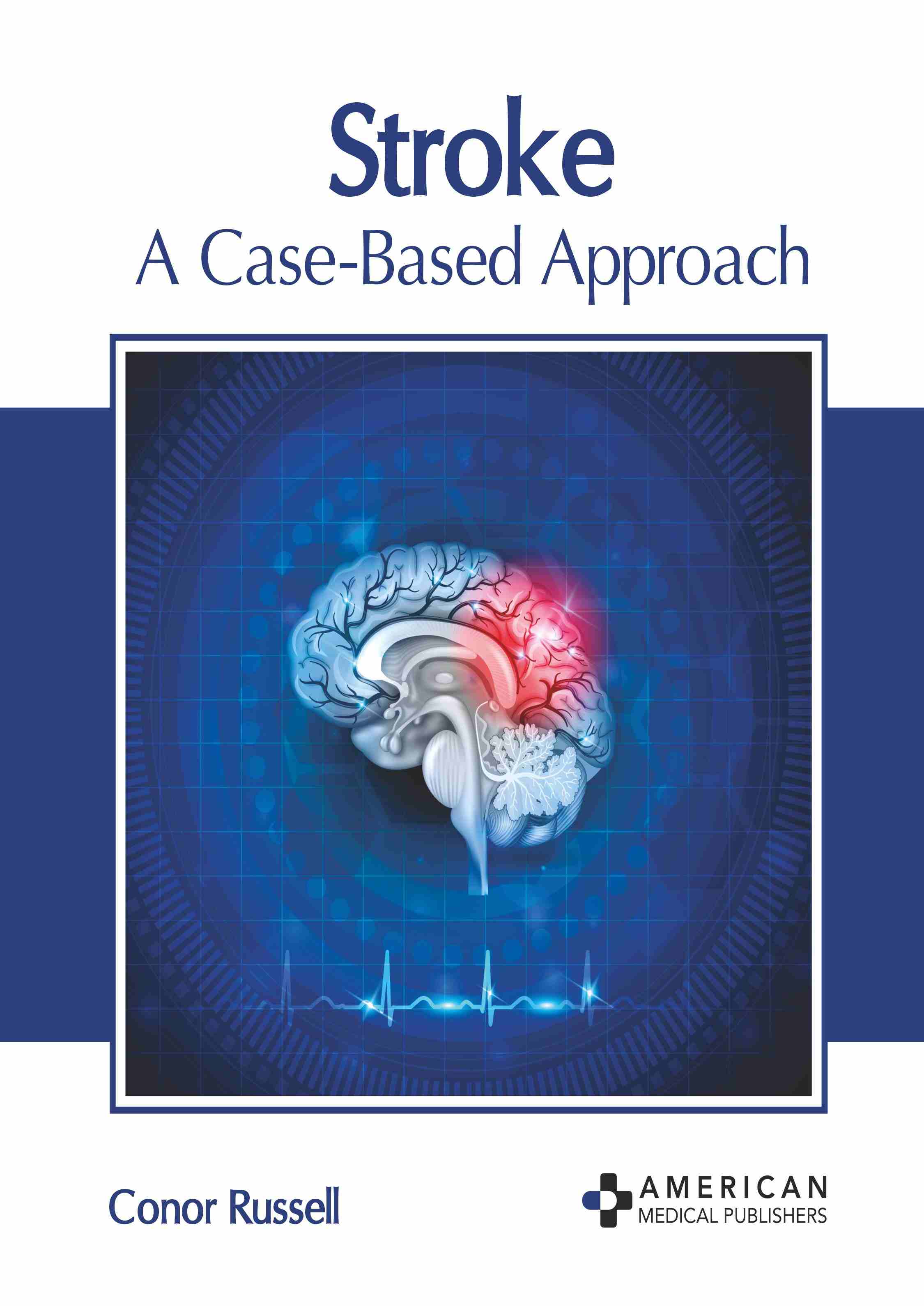 exclusive-publishers/american-medical-publishers/stroke-a-case-based-approach-9798887406589