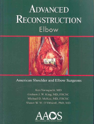

special-offer/special-offer/advanced-reconstruction-elbow-1-ed--9780892033911