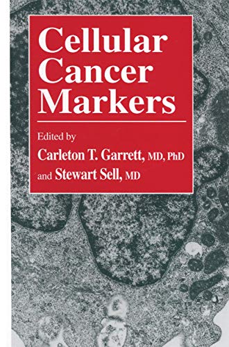 

special-offer/special-offer/cellular-cancer-markers-contemporary-biomedicine--9780896032101