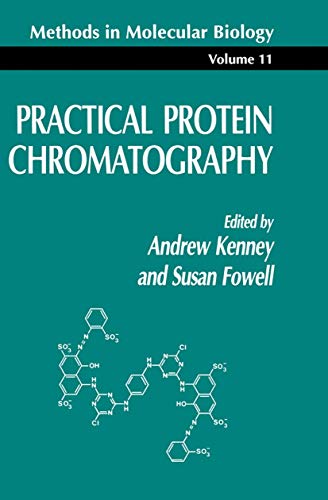 

special-offer/special-offer/practical-protein-chromatography-methods-in-molecular-biology--9780896032132