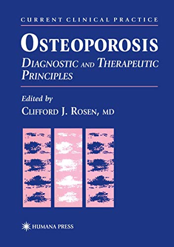 

special-offer/special-offer/osteoporosis-diagnostic-and-therapeutic-principles--9780896033740