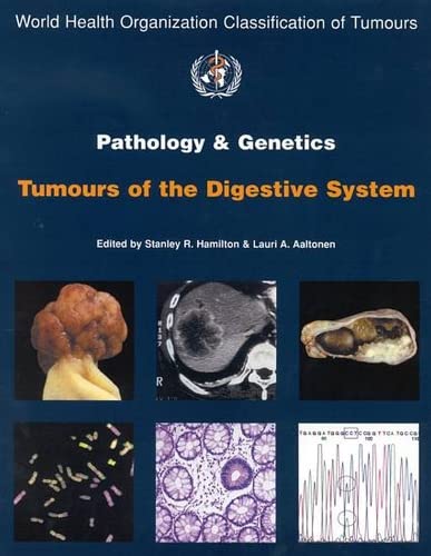 

general-books/general/pathology-genetics-tumours-of-the-digestive-system-1-ed--9789283224105