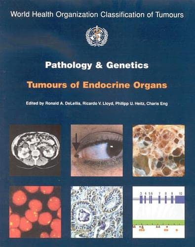 

general-books/general/pathology-genetics-tumours-of-endocrine-organs--9789283224167