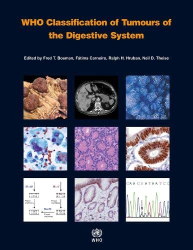 

general-books/general/who-classification-of-tumours-of-the-digestive-system-4ed--9789283224327