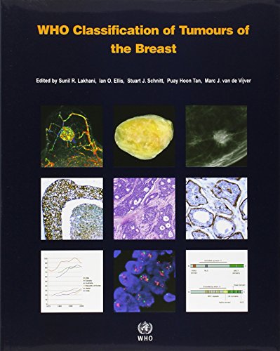 

clinical-sciences/hematology/who-classification-of-tumours-of-the-breast-4ed--9789283224334