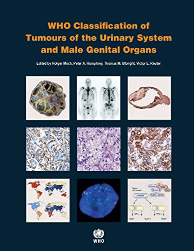 

general-books/general/who-classification-of-tumours-of-the-urinary-system-and-male-genital-organs-4-ed--9789283224372
