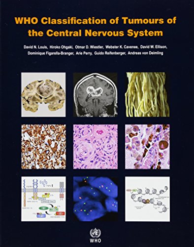 

clinical-sciences/medical/who-classification-of-tumors-of-the-central-nervous-system-revised-4-ed--9789283244929