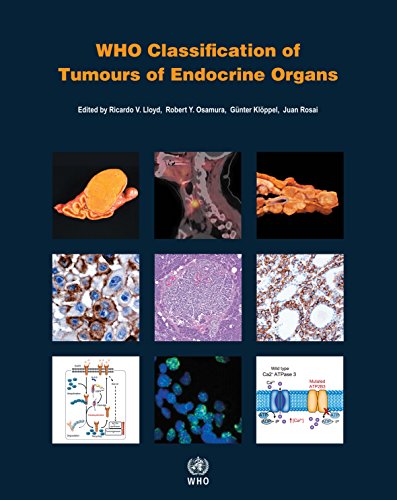 

clinical-sciences/endocrinology/who-classification-of-tumours-of-endocrine-organs-4-ed-9789283244936