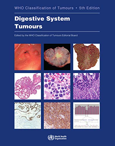 WHO CLASSIFICATION OF TUMOURS: DIGESTIVE SYSTEM TUMOURS