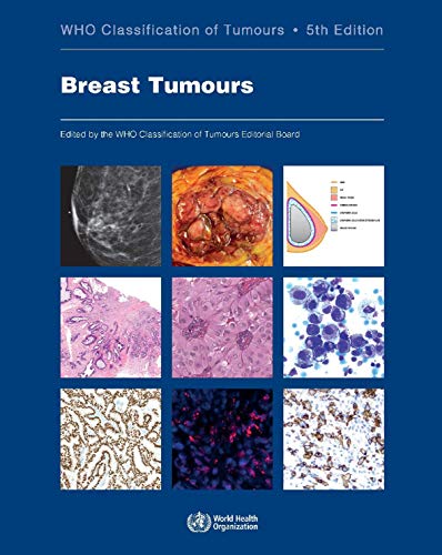 WHO CLASSIFICATION OF BREAST TUMORS