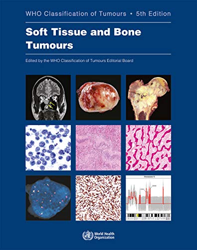 WHO CLASSIFICATION OF TUMORS OF SOFT TISSUE AND BONE