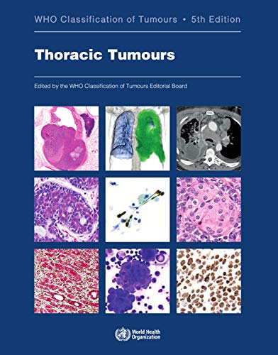 WHO CLASSIFICATION OF THORACIC TUMORS