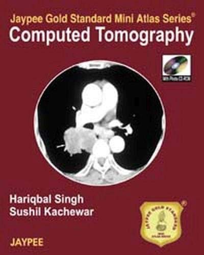 

best-sellers/jaypee-brothers-medical-publishers/computed-tomography-jaypee-gold-standard-mini-atlas-series-with-photo-cd-rom-9789350250532
