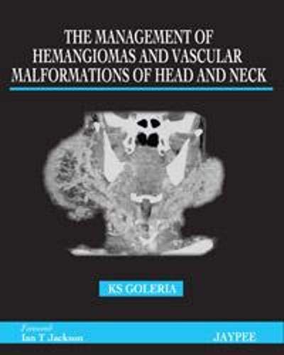 

best-sellers/jaypee-brothers-medical-publishers/the-management-of-hemangiomas-and-vascular-malformations-of-head-and-neck-9789350251256
