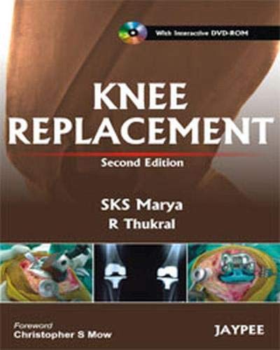 

best-sellers/jaypee-brothers-medical-publishers/knee-replacement-with-interactive-dvd-rom-9789350251683