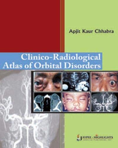 

best-sellers/jaypee-brothers-medical-publishers/clinico-radiological-atlas-of-orbital-disorders-9789350251911