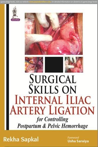 

best-sellers/jaypee-brothers-medical-publishers/surgical-skills-on-internal-iliac-artery-ligation-for-controlling-postpartum-pelvic-hemorrhage-9789350253786