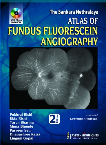 

best-sellers/jaypee-brothers-medical-publishers/the-sankara-nethralaya-atlas-of-fundus-fluorescein-angiography-with-photo-dvd-rom-9789350255773