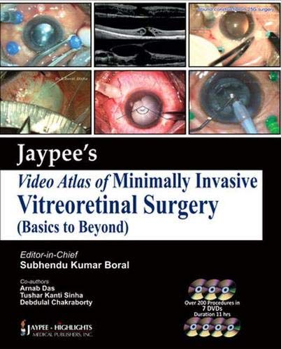 

best-sellers/jaypee-brothers-medical-publishers/jaypee-video-atlas-of-minimally-invasive-vitreoretinal-surgery-9789350902004