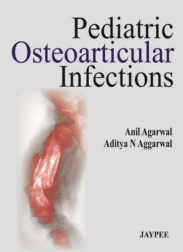 

mbbs/4-year/pediatric-osteoarticular-infections-9789350902899