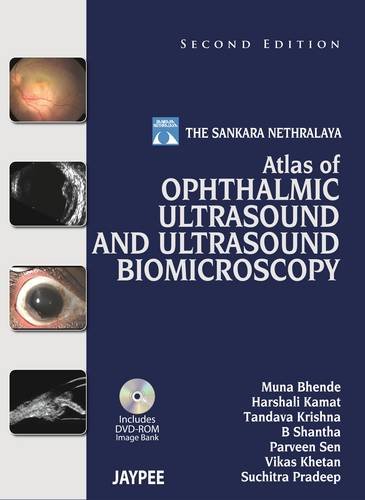 

best-sellers/jaypee-brothers-medical-publishers/the-sankara-nethralaya-atlas-of-ophthalmic-ultrasound-and-ultrasound-biomicroscopy-9789350905357