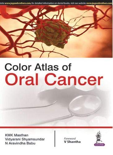 

best-sellers/jaypee-brothers-medical-publishers/color-atlas-of-oral-cancer-9789351524410