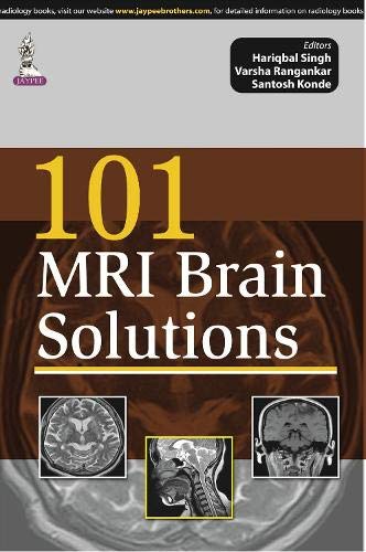 

best-sellers/jaypee-brothers-medical-publishers/101-mri-brain-solutions-9789351525530