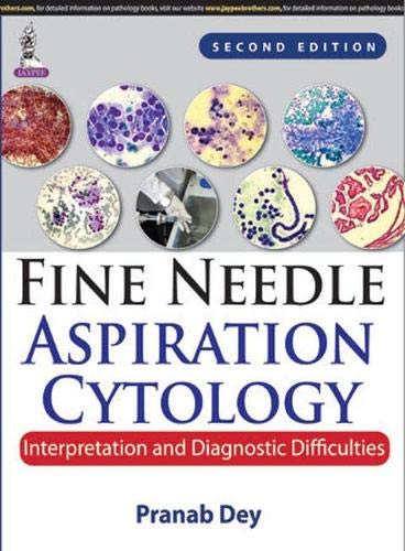 

best-sellers/jaypee-brothers-medical-publishers/fine-needle-aspiration-cytology-interpretation-and-diagnostic-difficulties-9789351526087