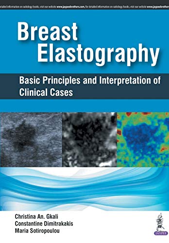 

best-sellers/jaypee-brothers-medical-publishers/breast-elastography-basic-principles-and-interpretation-of-clinical-cases-9789352700578