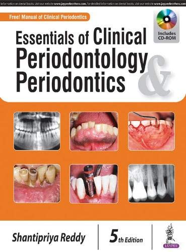 

general-books/general/essentials-of-clinical-periodontology-periodontics-with-cd-rom-free-manual-of-clinical-periodontics-5-ed--9789352701117