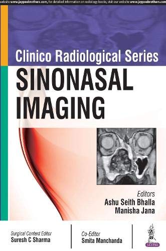 

general-books/general/clinico-radiological-series-sinonasal-imaging--9789352701711