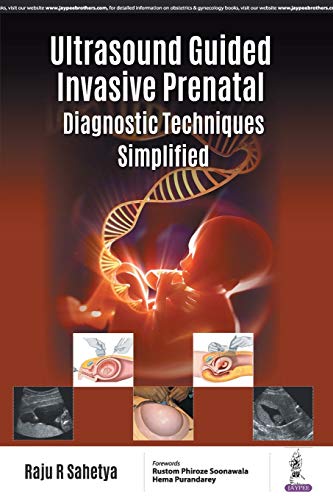 

best-sellers/jaypee-brothers-medical-publishers/ultrasound-guided-invasive-prenatal-diagnostic-techniques-simplified-9789352702336