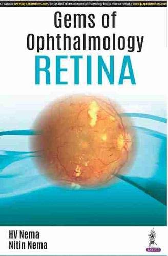 

best-sellers/jaypee-brothers-medical-publishers/gems-of-ophthalmology-retina-9789352704026