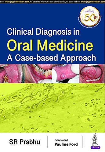 

best-sellers/jaypee-brothers-medical-publishers/clinical-diagnosis-in-oral-medicine-a-case-based-approach--9789352706068