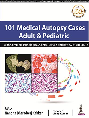 

best-sellers/jaypee-brothers-medical-publishers/101-medical-autopsy-cases-adult-pediatric-with-complete-pathological-clinical-details-and-review-9789352706129