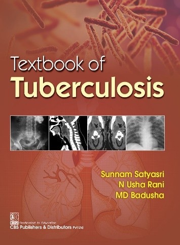 

best-sellers/cbs/textbook-of-tuberculosis-pb-2023--9789354660184
