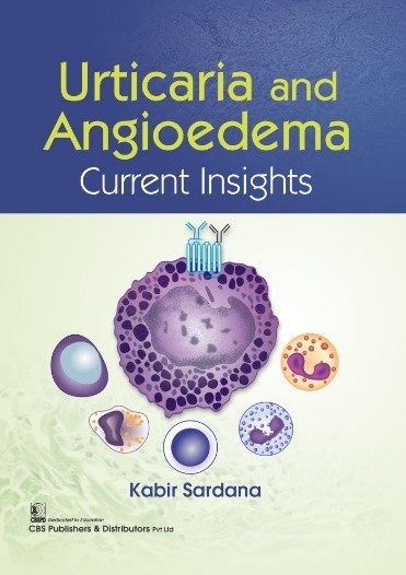 

best-sellers/cbs/urticaria-and-angioedema-current-insights-pb-2022--9789354664656