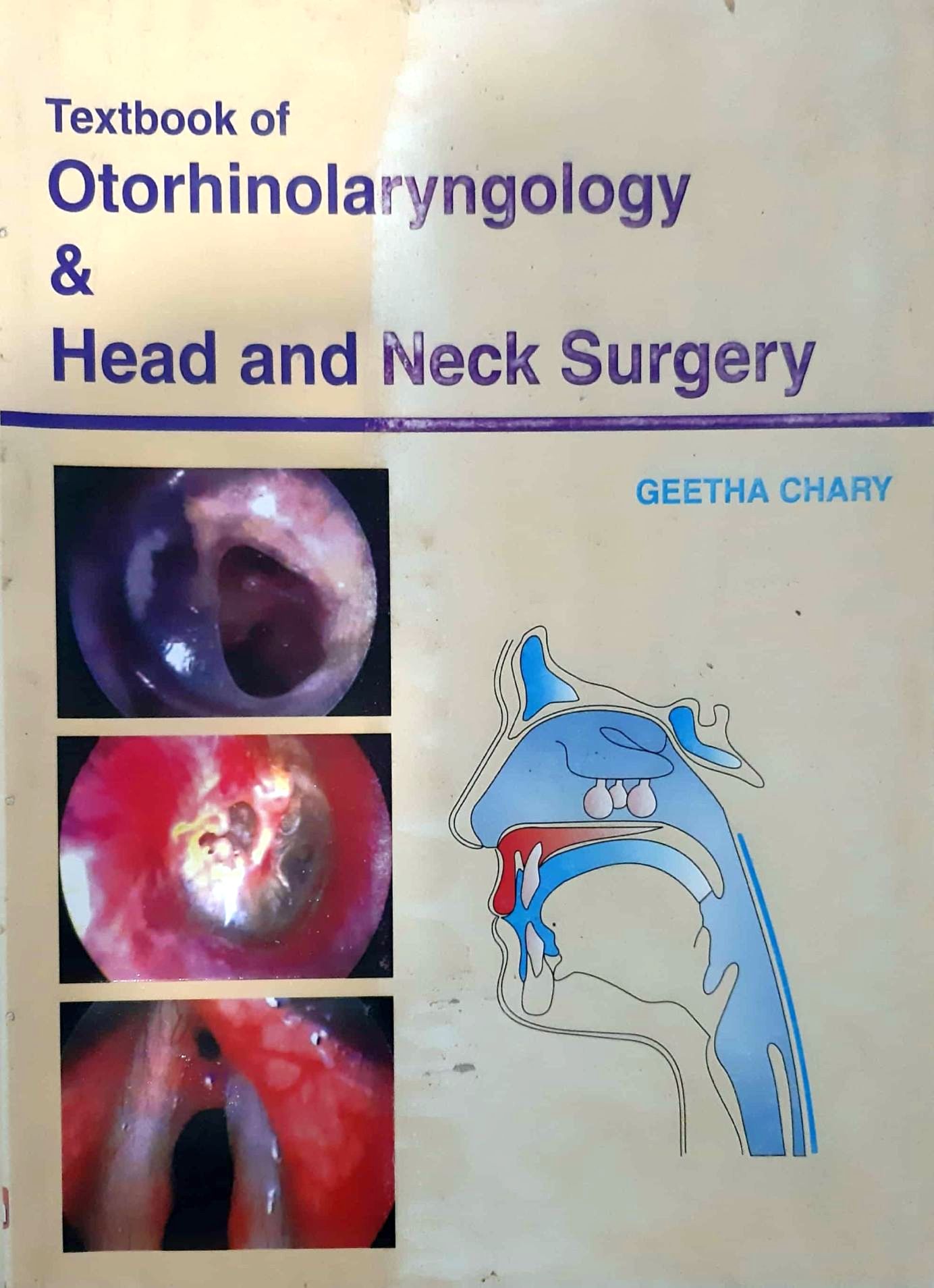 

surgical-sciences//textbook-of-otorhinolaryngology-head-and-neck-surgery-9789380316079