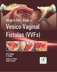 exclusive-publishers/ahuja-publishing-house/singh-s-text-book-of-vesico-vaginal-fistulas-vvfs--9789380316611