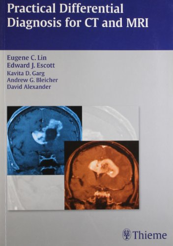 

exclusive-publishers/thieme-medical-publishers/practical-differential-diagnosis-for-ct-and-mri--9789380378060