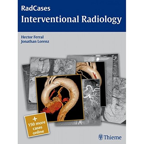 

mbbs/4-year/radcases-interventional-radiology-2-e-9789380378404