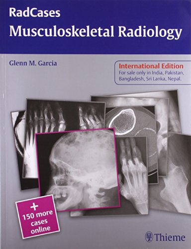 

exclusive-publishers/thieme-medical-publishers/radcases-musculoskeletal-radiology-international-edition-9789380378411
