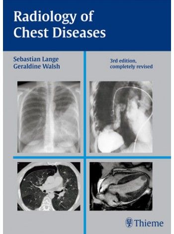 

exclusive-publishers/thieme-medical-publishers/radiology-of-chest-diseases-3-e--9789380378688