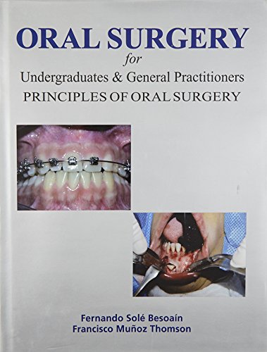 

dental-sciences/dentistry/oral-surgery-for-undergraduates-general-practitioners-principles-of-oral-surgery-9789381714140