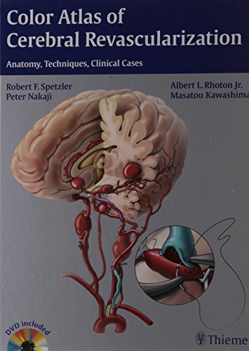 

exclusive-publishers/thieme-medical-publishers/color-atlas-of-cerebral-revascularization-anatomy-techniques-clinical-cases-1-e--9789382076421