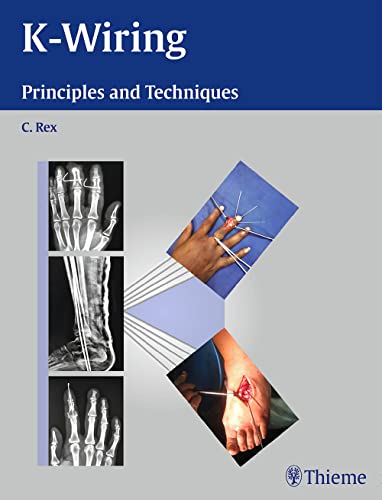 

exclusive-publishers/thieme-medical-publishers/k-wiring-principles-and-techniques-1-e--9789382076575